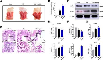 Aspirin in combination with gastrodin protects cardiac function and mitigates gastric mucosal injury in response to myocardial ischemia/reperfusion